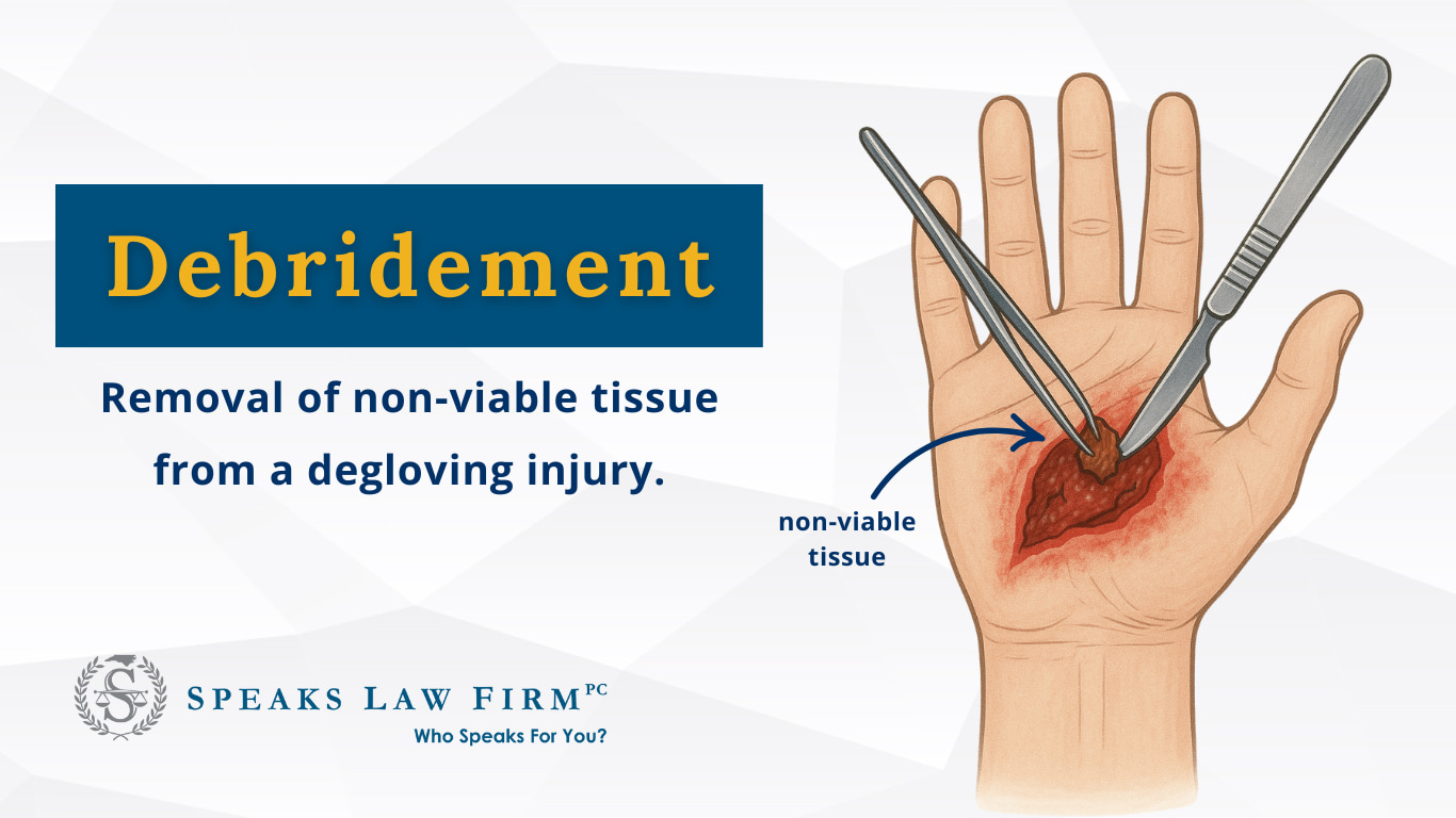 What Is a Degloving Injury in Wilmington, NC? 2 What Is a Degloving Injury in Wilmington, NC?