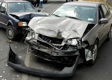 Common Types of Skull Fractures Experienced After A Car Accident